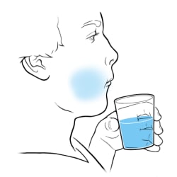 Person swishing water around in mouth.